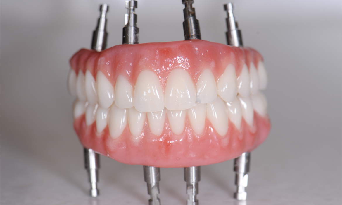 Зубы все на четырех